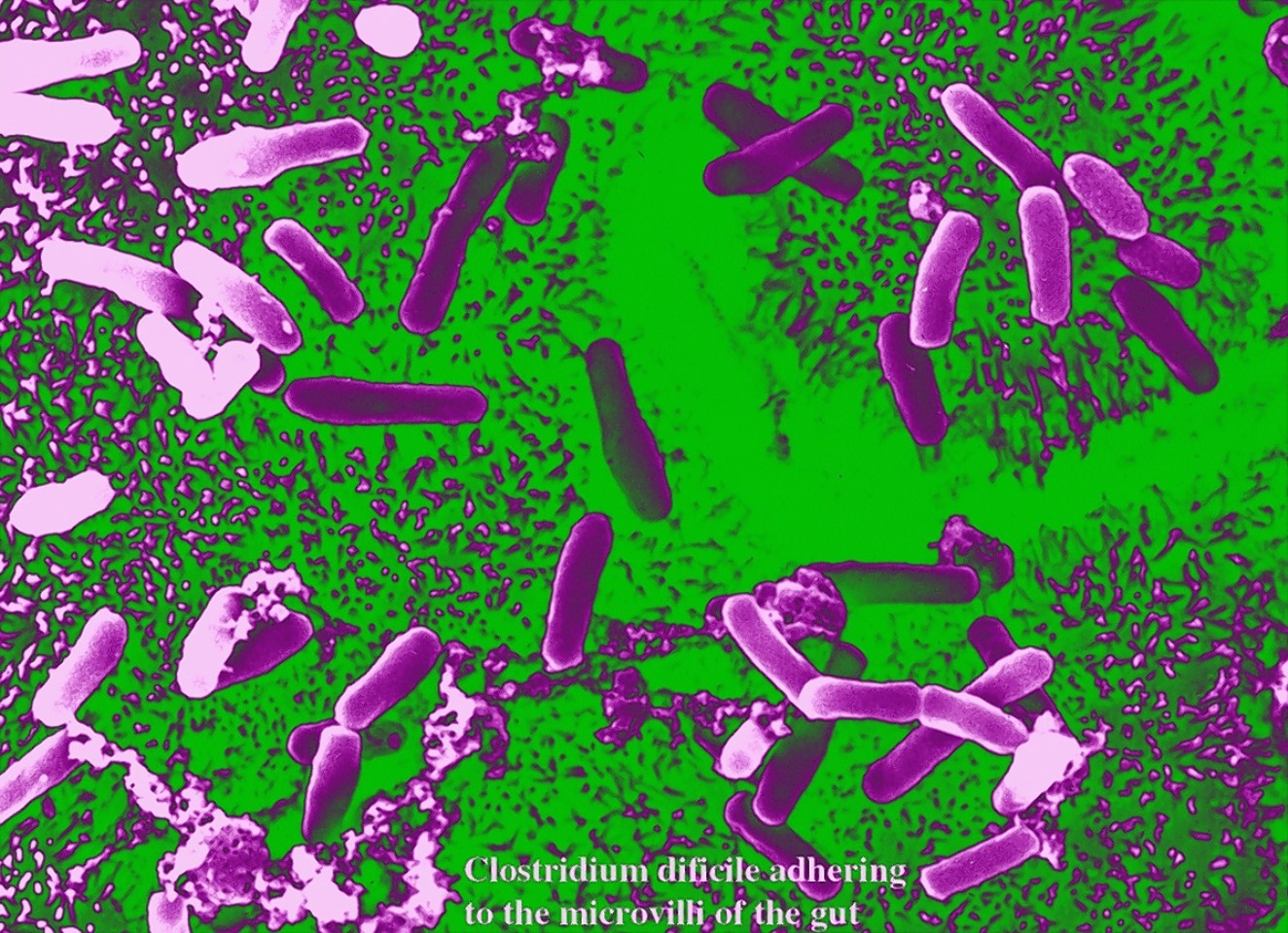 Клостридиум диффициле. Клостридиум ботулинум микробиология. Clostridium difficile микробиология. Клостридии столбняка микробиология.